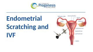 Endometrial Scratching and IVF.pptx